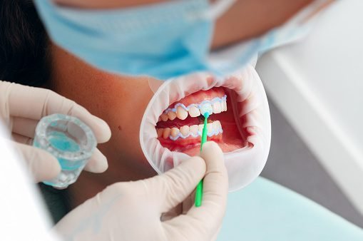 Choosing the Right Cosmetic Dentist: Tips for Finding a Qualified and Experienced Professional